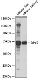 Anti-DPYS antibody used in Western Blot (WB). GTX54041