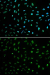 Anti-ELAVL1 / HuR antibody used in Immunocytochemistry/ Immunofluorescence (ICC/IF). GTX54044