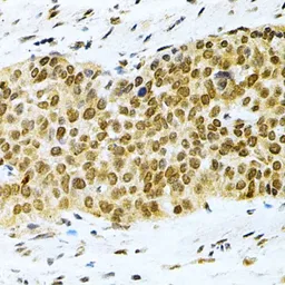 Anti-ELAVL1 / HuR antibody used in IHC (Paraffin sections) (IHC-P). GTX54044