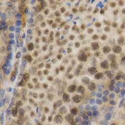 Anti-ELAVL1 / HuR antibody used in IHC (Paraffin sections) (IHC-P). GTX54044
