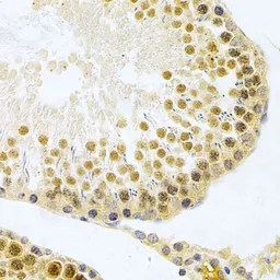 Anti-ELAVL1 / HuR antibody used in IHC (Paraffin sections) (IHC-P). GTX54044