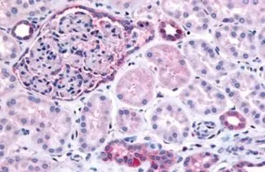 Anti-PIB5PA antibody used in IHC (Paraffin sections) (IHC-P). GTX54063