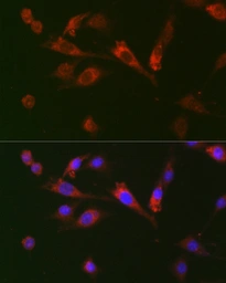Anti-GDF15 antibody used in Immunoprecipitation (IP). GTX54079