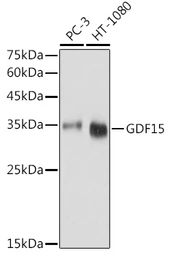 Anti-GDF15 antibody used in Western Blot (WB). GTX54079