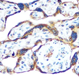 Anti-GDF15 antibody used in IHC (Paraffin sections) (IHC-P). GTX54079