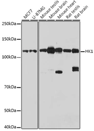 Anti-Hexokinase 1 antibody used in Western Blot (WB). GTX54080