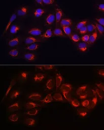 Anti-Hexokinase 1 antibody used in Immunocytochemistry/ Immunofluorescence (ICC/IF). GTX54080