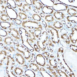 Anti-Hexokinase 1 antibody used in IHC (Paraffin sections) (IHC-P). GTX54080