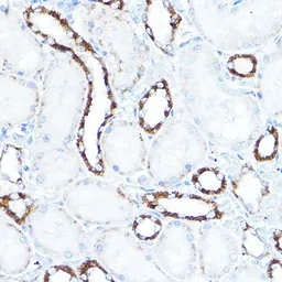Anti-Hexokinase 1 antibody used in IHC (Paraffin sections) (IHC-P). GTX54080