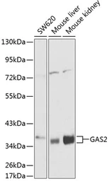 Anti-GAS2 antibody used in Western Blot (WB). GTX54081