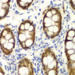 Anti-GIPC2 antibody used in IHC (Paraffin sections) (IHC-P). GTX54083