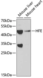 Anti-HFE antibody used in Western Blot (WB). GTX54085