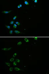 Anti-HFE antibody used in Immunocytochemistry/ Immunofluorescence (ICC/IF). GTX54085