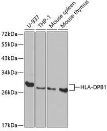 Anti-HLA-DPB1 antibody used in Western Blot (WB). GTX54086