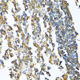 Anti-HLA-DPB1 antibody used in IHC (Paraffin sections) (IHC-P). GTX54086