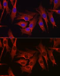 Anti-HMGCR antibody used in Immunocytochemistry/ Immunofluorescence (ICC/IF). GTX54088