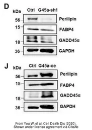 Anti-GADD45A antibody used in Western Blot (WB). GTX54090