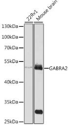 Anti-GABA A Receptor alpha 2 antibody used in Western Blot (WB). GTX54091