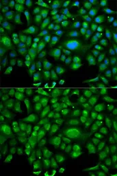 Anti-HSP70 1L antibody used in Immunocytochemistry/ Immunofluorescence (ICC/IF). GTX54093