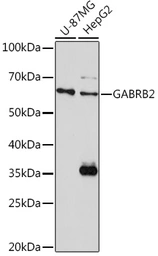 Anti-GABA A Receptor beta 2 antibody used in Western Blot (WB). GTX54094