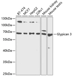 Anti-Glypican-3 antibody used in Western Blot (WB). GTX54096