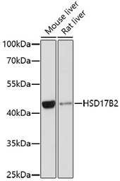 Anti-HSD17B2 antibody used in Western Blot (WB). GTX54097