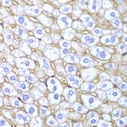 Anti-HLA-A antibody used in IHC (Paraffin sections) (IHC-P). GTX54099