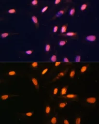 Anti-Histone H3K4me1 (mono-methyl Lys4) antibody used in Immunocytochemistry/ Immunofluorescence (ICC/IF). GTX54100