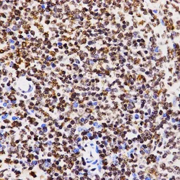 Anti-Histone H3K4me1 (mono-methyl Lys4) antibody used in IHC (Paraffin sections) (IHC-P). GTX54100