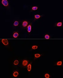 Anti-Histone H3K9me1 (mono-methyl Lys9) antibody used in Immunocytochemistry/ Immunofluorescence (ICC/IF). GTX54101