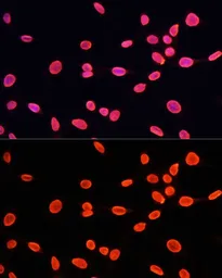 Anti-Histone H3K9me1 (mono-methyl Lys9) antibody used in Immunocytochemistry/ Immunofluorescence (ICC/IF). GTX54101