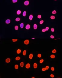 Anti-Histone H3K9me1 (mono-methyl Lys9) antibody used in Immunocytochemistry/ Immunofluorescence (ICC/IF). GTX54101