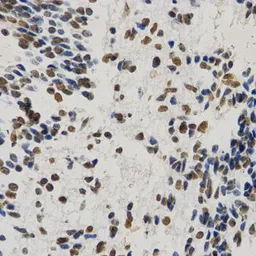 Anti-Histone H3K9me1 (mono-methyl Lys9) antibody used in IHC (Paraffin sections) (IHC-P). GTX54101