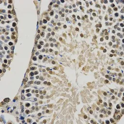 Anti-Histone H3K9me1 (mono-methyl Lys9) antibody used in IHC (Paraffin sections) (IHC-P). GTX54101