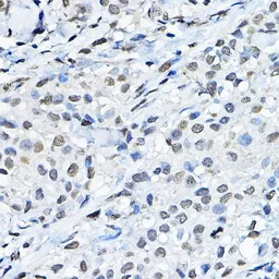 Anti-Histone H3K27me1 (mono-methyl Lys27) antibody used in IHC (Paraffin sections) (IHC-P). GTX54104