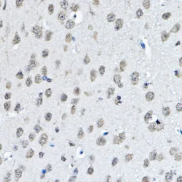Anti-Histone H3K27me1 (mono-methyl Lys27) antibody used in IHC (Paraffin sections) (IHC-P). GTX54104