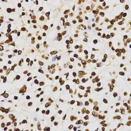 Anti-Histone H3K27me2 (di-methyl Lys27) antibody used in IHC (Paraffin sections) (IHC-P). GTX54105