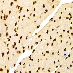 Anti-Histone H3K27me2 (di-methyl Lys27) antibody used in IHC (Paraffin sections) (IHC-P). GTX54105