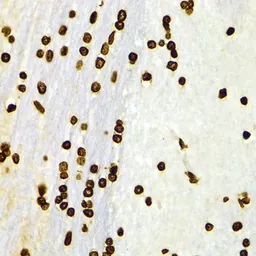 Anti-Histone H3K27me2 (di-methyl Lys27) antibody used in IHC (Paraffin sections) (IHC-P). GTX54105