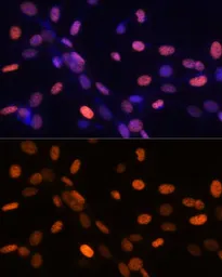 Anti-Histone H3K27me3 (tri-methyl Lys27) antibody used in Immunocytochemistry/ Immunofluorescence (ICC/IF). GTX54106