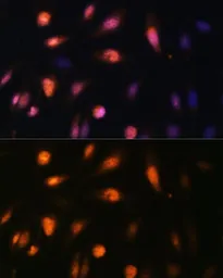 Anti-Histone H3K27me3 (tri-methyl Lys27) antibody used in Immunocytochemistry/ Immunofluorescence (ICC/IF). GTX54106