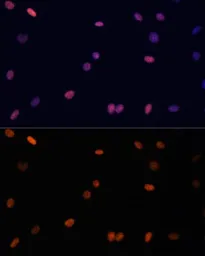 Anti-Histone H3K27me3 (tri-methyl Lys27) antibody used in Immunocytochemistry/ Immunofluorescence (ICC/IF). GTX54106