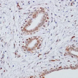 Anti-Histone H3K27me3 (tri-methyl Lys27) antibody used in IHC (Paraffin sections) (IHC-P). GTX54106