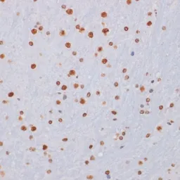 Anti-Histone H3K27me3 (tri-methyl Lys27) antibody used in IHC (Paraffin sections) (IHC-P). GTX54106