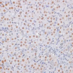 Anti-Histone H3K27me3 (tri-methyl Lys27) antibody used in IHC (Paraffin sections) (IHC-P). GTX54106