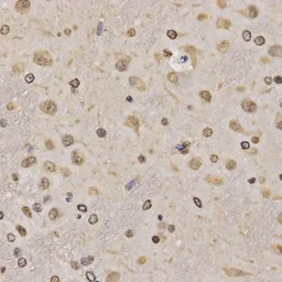 Anti-Histone H3K36me1 (mono-methyl Lys36) antibody used in IHC (Paraffin sections) (IHC-P). GTX54107