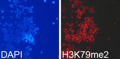 Anti-Histone H3K79me2 (di-methyl Lys79) antibody used in Immunocytochemistry/ Immunofluorescence (ICC/IF). GTX54110