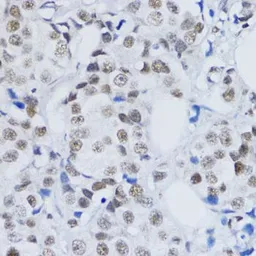Anti-Histone H3K79me2 (di-methyl Lys79) antibody used in IHC (Paraffin sections) (IHC-P). GTX54110