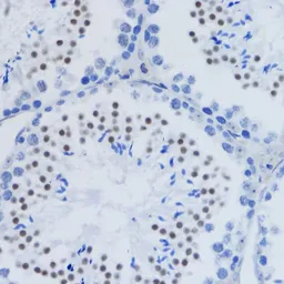 Anti-Histone H3K79me2 (di-methyl Lys79) antibody used in IHC (Paraffin sections) (IHC-P). GTX54110