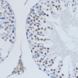 Anti-Histone H3K79me2 (di-methyl Lys79) antibody used in IHC (Paraffin sections) (IHC-P). GTX54110